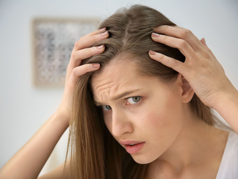 Rụng tóc sau giảm cân do thiếu hụt chất dinh dưỡng