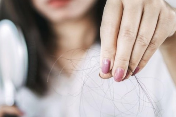 Nguyên nhân và cách phòng tránh rụng tóc sau khi giảm cân